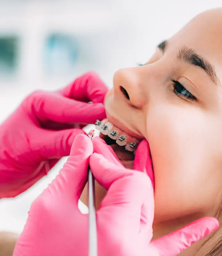 Orthodontist-Working-on-Girl's-Braces
